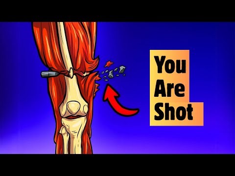 What Does It Really Feel Like to Get Shot? | Science of Pain Explained