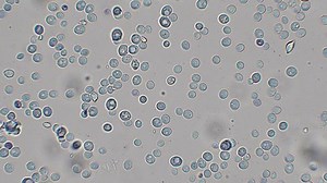 clip-1099771303-yeast-cells-under-microscope-bakery---optical