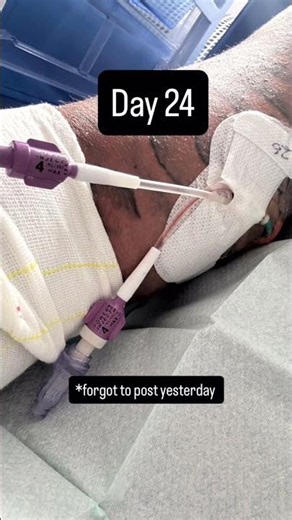 42 days - 42 doses of antibiotics - 84 journeys - 1 PICC Line