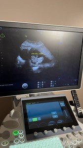 9.1K reactions · 527 shares | One of the sweetest moments during...