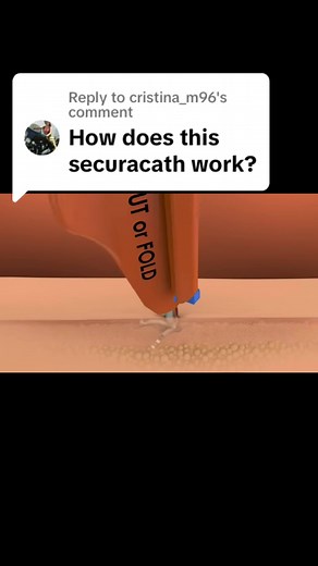 TheVascularGuy on TikTok