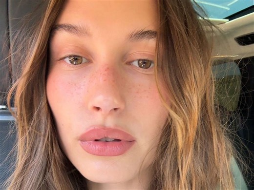 PRP vs. PRF: Which of Hailey Bieber's Go-To Skin Treatments Should You Try?