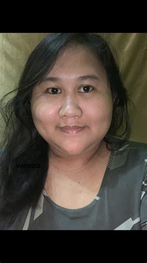 Operasi Mata Juling: Perjalanan Sebelum dan Sesudah