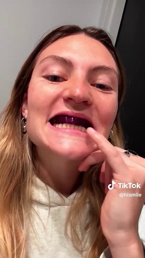 Teeth Whitening Results with HiSmile Strips Explained