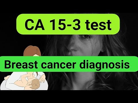 CA 15-3 test | Breast cancer diagnosis | tumor marker (Everything you need to know)