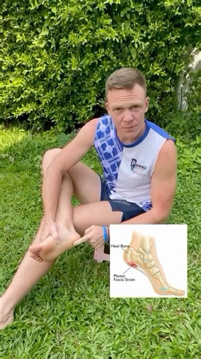 Heel spur? Does it hurt to step on your heel? #plantarfasciitis #heelspur #runningtips