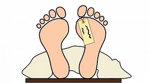 How is autopsy performed | How is autopsy performed