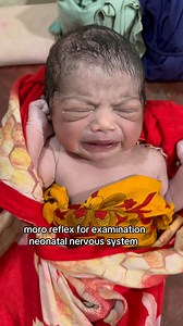 moro reflex test | Dr. Ataur Rahman