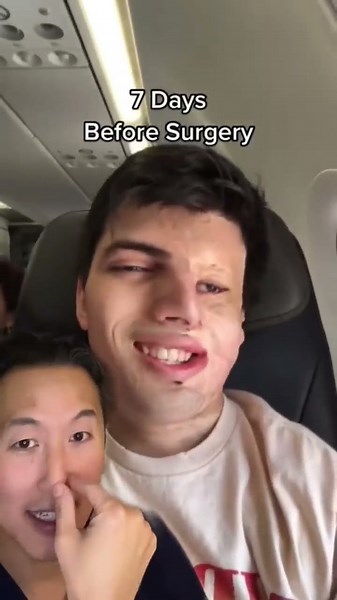 Countdown to Nasal Reconstruction Surgery! #shorts #nasalreconstruction