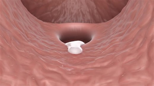 Understanding White Discharge and Menstrual Pain