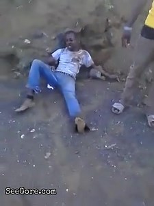 Man viciously attacked by machete - SeeGore