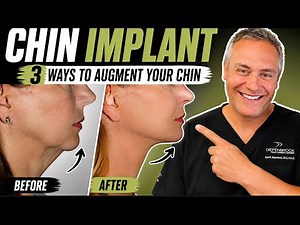 Chin Implant vs. Filler vs. Sliding Genioplasty: Which Is Right for You?