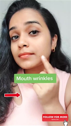 Effective Ways to Get Rid of Mouth Wrinkles and Laugh Lines