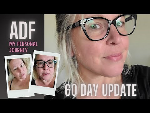 Alternate Day Fasting for 60 DAYS! ADF Weight Loss Journey and Results
