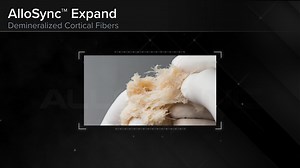 AlloSync™ Expand Demineralized Cortical Fibers for Spinal Fusion Cases