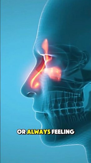 Nasal Turbinate surgery and Symptoms #3danimation #healtheducation #symptoms #nasalcavity #pain