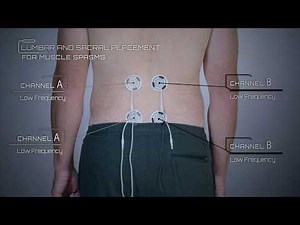 Lumbar and Sacral Placement Example