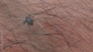 Tick crawling on person's arm. A mature sheep tick (Ixodes ricinus) moving through hair on man's skin
