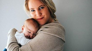 Dua Faktor Penyebab Terjadinya Bibir Sumbing, Berikut Ulasan Dokter - TribunHealth.com