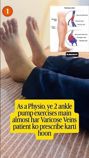 As a Physiotherapist, I Recommend These 2 Ankle Pump Exercises for Varicose Veins