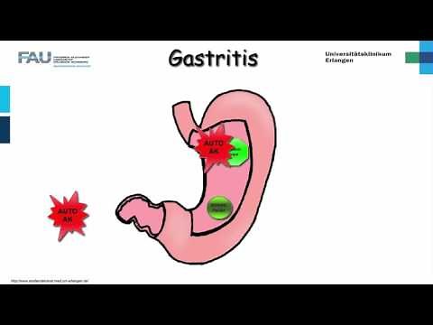 Internal Medicine ─ Gastritis