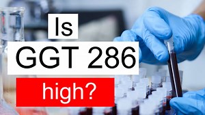 Treatment and symptoms of GGT 286 U/L | Diet for high Gamma glutamyl transferase level 286 U/L