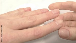 White spots on the fingernails, symptoms of iron deficiency anemia. Examination and diagnosis of the nail disease