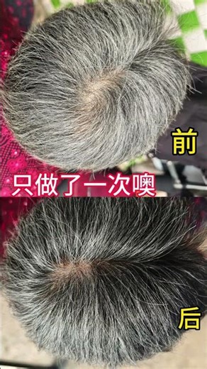 Shuangqi's Ancient Secret: Unveiling the Miracles of Traditional Chinese Medicine