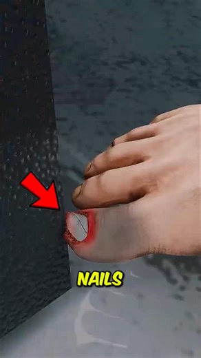 Why Biting Your Nails Is Worse Than You Think