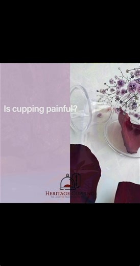 Cupping therapy, when performed by a licensed and experienced practitioner, should not be painful. While some individuals may experience a sensation of tightness or mild discomfort during the procedure, it is generally well-tolerated. The therapy may result in temporary bruising, known as ecchymosis, as well as possible swelling or soreness, depending on the individual and the extent of the treatment. These marks are a natural response and typically fade within several days to a week. The benefi