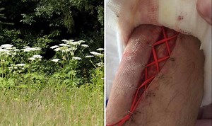 Hogweed: Expert explains dangers of plant