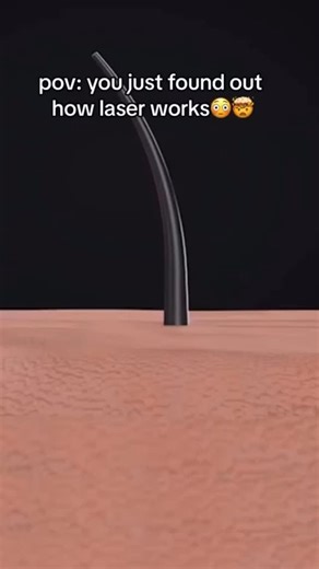 Curious about how laser hair removal works? ✨ Here’s the science behind the smoothness: Laser hair removal uses advanced technology to target hair follicles with concentrated light. The laser’s energy is absorbed by the pigment (melanin) in the hair, heating up the follicle and effectively disabling its ability to grow new hair. ✅ What to expect: 1️⃣ The treatment focuses on the active growth phase of hair (known as the anagen phase), so multiple sessions are needed to catch all hairs at this st