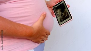pregnant woman holds mobile phone with ultrasound screen examination, small child rolls over in mother's belly, concept pregnancy reproduction, healthcare pregnancy, happy motherhood, selective focus