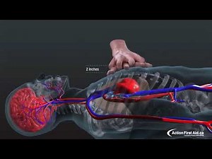 Cardio pulmonary resuscitation (CPR) animation