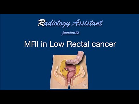 MRI in Rectal Cancer - Lecture 2 - tumor in the low rectum