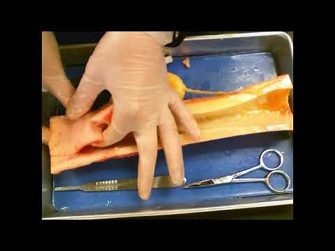 Long Bone Dissection