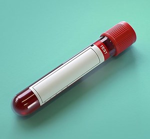 Allergy Testing Service