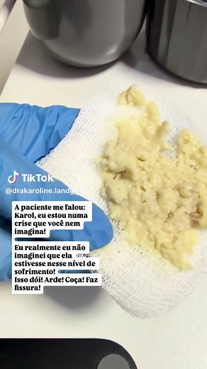 SOS PERERECA: Alívio Rápido para Mulheres em Crise