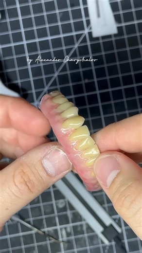 Trying a new gingiva buildup technique on a removable denture. Teeth: Vita Physiodens, composite: Pekkso Shofu mix. #removabledenture #dentureart #denturetech #dentaltechnician #VitaPhysiodens #Pekkso #Shofu #gingivabuildup #aestheticdentures #orthosect #denturelife #dentalcraft #prosthetics #handcrafted | Tkachov Sergey