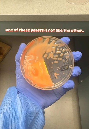 Rhodotorula vs Candida: identifying salmon-colored yeast colonies
