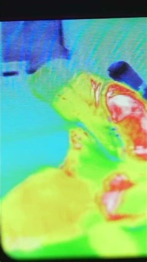 Fire District vs Fire Department | Kuna Fire District