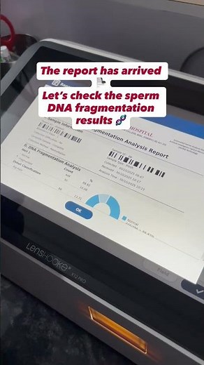 LensHooke X12 Pro Analysis!