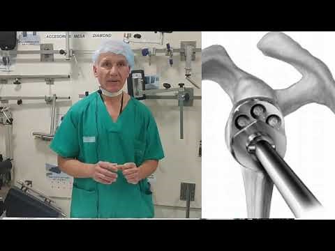 protesis de hombro invertida Equinoxe