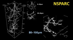 There are plenty of #SuperResolution #Microscopy techniques to choose from, but how many are photon budget-friendly and applicable at depths greater than 100 µm? The Nikon Spatial Array Confocal (NSPARC) detector brings the power of #ImageScanningMicroscopy #ISM to our AX / AX R #Confocal system, providing a robust option for superresolution in complex 3D samples. Learn more: https://bit.ly/3JyKRTW | Nikon Microscope Solutions