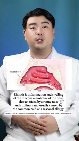 Alagaan ang Allergic Rhinitis: Tips at Solusyon