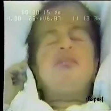 The debate over dopamine's role in reward: the case for incentive salience