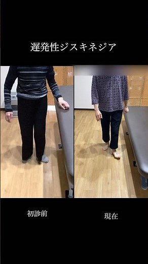 遅発性ジスキネジア #パーキンソン病 #parkinson #dyskinesia