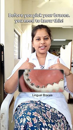 types of braces used in dental care #Orthodontist #braces #typesofbraces #orthotips #dentistry