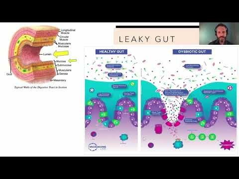Restore Your Gut: Discover the Science of Total Gut Restoration with Dr. Sam Madeira