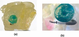 How to Go Trans-septal if the Door is Closed: Mitraclip Placement in a Patient with Prior Atrial Septal Defect Closure Device with the Assistance of 3-D Printing